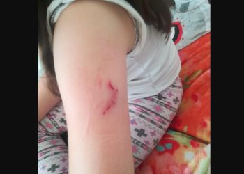 Pies pogryzł dziecko. Czy musi dojść do tragedii?