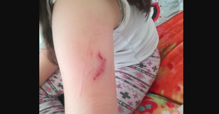 Pies pogryzł dziecko. Czy musi dojść do tragedii?