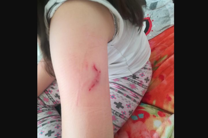 Pies pogryzł dziecko. Czy musi dojść do tragedii?