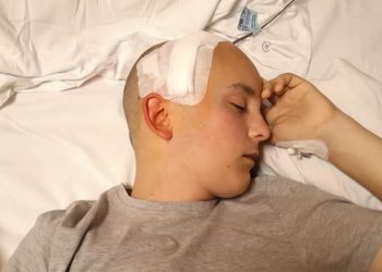 Lekarzom udało się usunąć całego guza