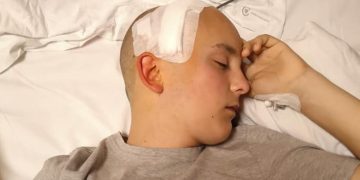 Lekarzom udało się usunąć całego guza