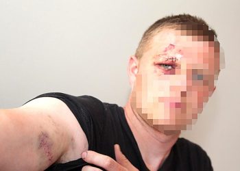 Oskarżał ochroniarzy. Jest decyzja prokuratora