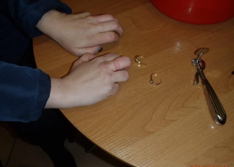 Strażacy usunęli pierścionki