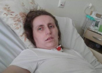 Rehabilitacja przynosi efekty. Agnieszka się obudziła!