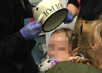 Zdjęli garnek z głowy dziecka. Jak to zrobili?