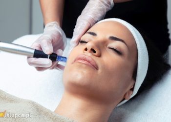 Dermapen – odmładzanie przez nakłuwanie