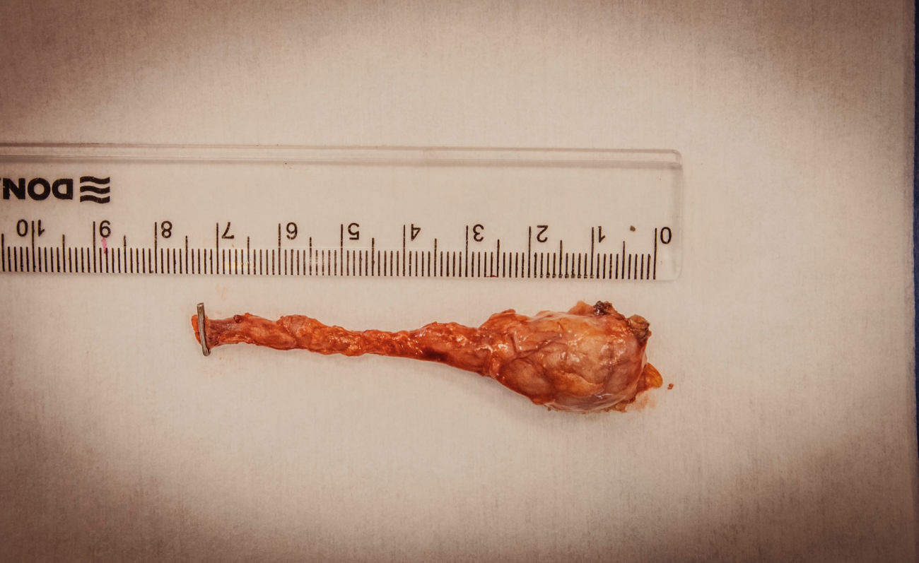 Taka sytuacja zdarza się bardzo rzadko