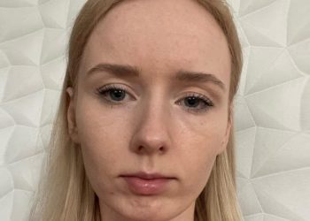 Oliwia potrzebuje pilnej operacji