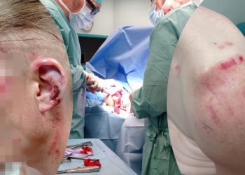 Pobili go do nieprzytomności, musiał przejść operację. „Złożymy wizytę napastnikom”