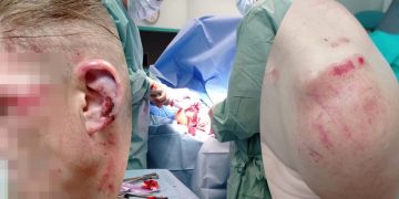 Pobili go do nieprzytomności, musiał przejść operację. „Złożymy wizytę napastnikom”