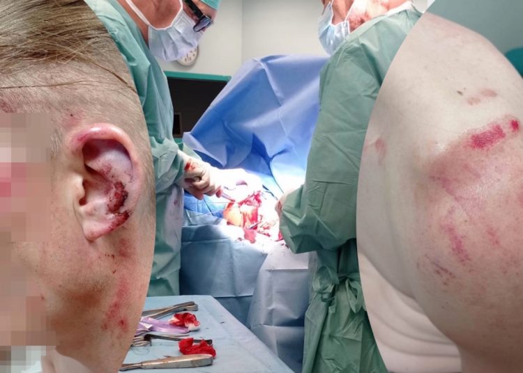 Pobili go do nieprzytomności, musiał przejść operację. „Złożymy wizytę napastnikom”