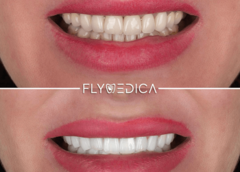 Uśmiech na czerwonym dywanie — Dentystyczne tajemnice hollywoodzkich gwiazd