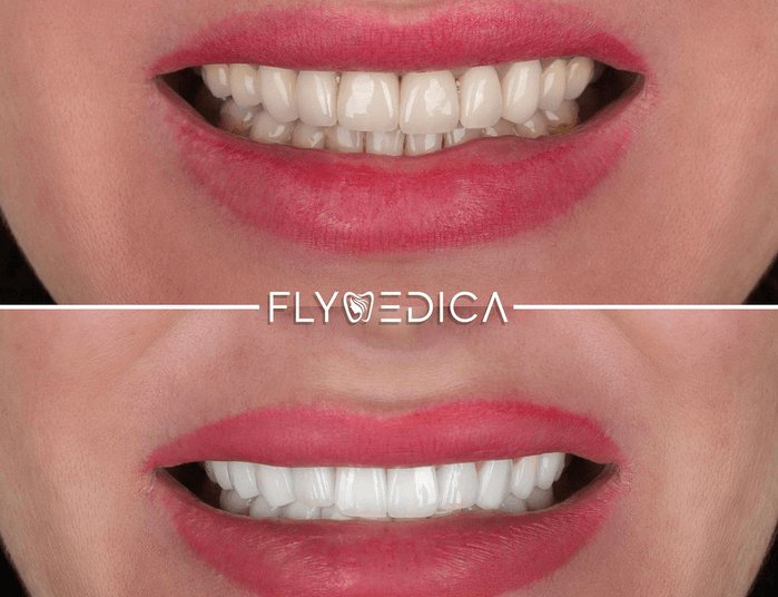 Uśmiech na czerwonym dywanie — Dentystyczne tajemnice hollywoodzkich gwiazd