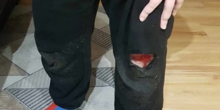 „Są w Słupcy o wiele pilniejsze potrzeby niż remont pomnika”