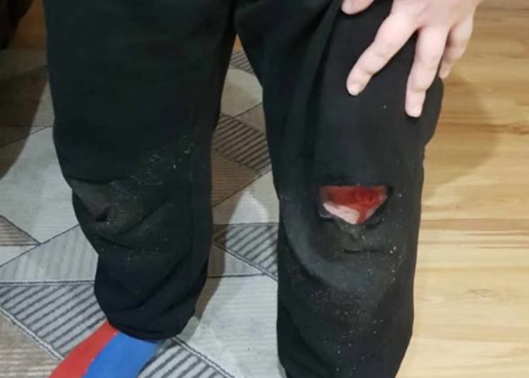 „Są w Słupcy o wiele pilniejsze potrzeby niż remont pomnika”