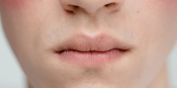 „Zapadnięta” środkowa część twarzy – dlaczego znika jej objętość?