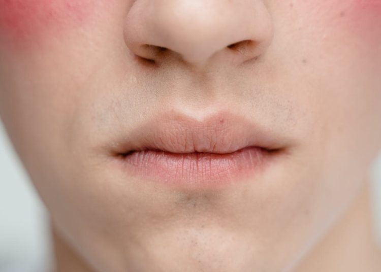 „Zapadnięta” środkowa część twarzy – dlaczego znika jej objętość?